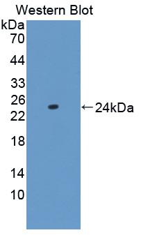 CRYGS Antibody - Western blot of CRYGS antibody.