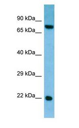 CRYGS Antibody - CRYGS antibody Western Blot of Rat Testis.  This image was taken for the unconjugated form of this product. Other forms have not been tested.