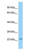 CRYGS Antibody - CRYGS antibody Western Blot of Rat Stomach.  This image was taken for the unconjugated form of this product. Other forms have not been tested.