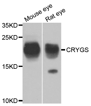 CRYGS Antibody - Western blot analysis of extracts of mouse eye and rat eye.