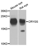 CRYGS Antibody - Western blot analysis of extracts of mouse eye and rat eye.