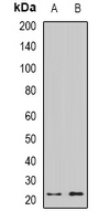 CRYGS Antibody - Western blot analysis of Gamma-S-crystallin expression in mouse eye (A); rat eye (B) whole cell lysates.