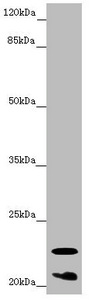 CRYGS Antibody - Western blot All Lanes:CRYGS antibody at 6.87 ug/ml + Mouse eye tissue Secondary Goat polyclonal to rabbit IgG at 1/10000 dilution Predicted band size: 21 kDa Observed band size: 21,23 kDa