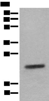 CRYGS Antibody - Western blot analysis of Mouse eye tissue lysate  using CRYGS Polyclonal Antibody at dilution of 1:800