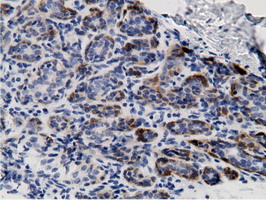 CRYM Antibody - IHC of paraffin-embedded Human breast tissue using anti-CRYM mouse monoclonal antibody.