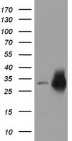CRYM Antibody - HEK293T cells were transfected with the pCMV6-ENTRY control (Left lane) or pCMV6-ENTRY CRYM (Right lane) cDNA for 48 hrs and lysed. Equivalent amounts of cell lysates (5 ug per lane) were separated by SDS-PAGE and immunoblotted with anti-CRYM.