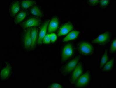 CRYM Antibody - Immunofluorescence staining of A549 cells at a dilution of 1:166, counter-stained with DAPI. The cells were fixed in 4% formaldehyde, permeabilized using 0.2% Triton X-100 and blocked in 10% normal Goat Serum. The cells were then incubated with the antibody overnight at 4 °C.The secondary antibody was Alexa Fluor 488-congugated AffiniPure Goat Anti-Rabbit IgG (H+L) .