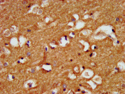 CRYM Antibody - Immunohistochemistry image at a dilution of 1:500 and staining in paraffin-embedded human brain tissue performed on a Leica BondTM system. After dewaxing and hydration, antigen retrieval was mediated by high pressure in a citrate buffer (pH 6.0) . Section was blocked with 10% normal goat serum 30min at RT. Then primary antibody (1% BSA) was incubated at 4 °C overnight. The primary is detected by a biotinylated secondary antibody and visualized using an HRP conjugated SP system.