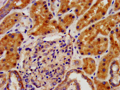 CRYM Antibody - Immunohistochemistry image at a dilution of 1:500 and staining in paraffin-embedded human kidney tissue performed on a Leica BondTM system. After dewaxing and hydration, antigen retrieval was mediated by high pressure in a citrate buffer (pH 6.0) . Section was blocked with 10% normal goat serum 30min at RT. Then primary antibody (1% BSA) was incubated at 4 °C overnight. The primary is detected by a biotinylated secondary antibody and visualized using an HRP conjugated SP system.