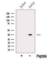 CRYM Antibody - Western blot analysis of extracts of Jurkat cells using muCrystallin antibody. The lane on the left was treated with blocking peptide.