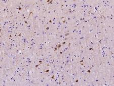 CRYM Antibody - Immunochemical staining of human CRYM in human brain with rabbit polyclonal antibody at 1:1000 dilution, formalin-fixed paraffin embedded sections.