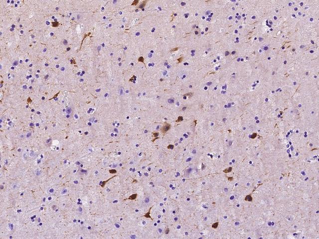 CRYM Antibody - Immunochemical staining of human CRYM in human brain with rabbit polyclonal antibody at 1:1000 dilution, formalin-fixed paraffin embedded sections.