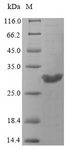 OPRT Protein - (Tris-Glycine gel) Discontinuous SDS-PAGE (reduced) with 5% enrichment gel and 15% separation gel.