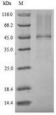 OPRT Protein - (Tris-Glycine gel) Discontinuous SDS-PAGE (reduced) with 5% enrichment gel and 15% separation gel.