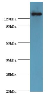 Crystal Protein cry1Ac Antibody - Western blot. All lanes: Kurstaki Pesticidal crystal protein cry1Ac antibody at 2 ug/ml+recombinant Kurstaki Pesticidal crystal protein cry1Ac protein at 1ug. Secondary antibody: Goat polyclonal to rabbit at 1:10000 dilution.  This image was taken for the unconjugated form of this product. Other forms have not been tested.