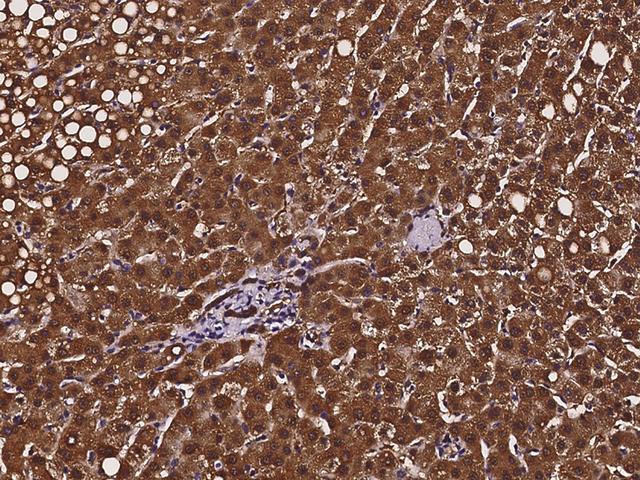 CRYZ Antibody - Immunochemical staining of human CRYZ in human liver with rabbit polyclonal antibody at 1:500 dilution, formalin-fixed paraffin embedded sections.