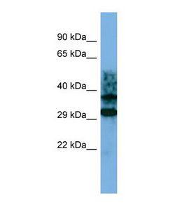 CRYZL1 Antibody - Western blot of Human Jurkat. CRYZL1 antibody dilution 1.0 ug/ml.  This image was taken for the unconjugated form of this product. Other forms have not been tested.