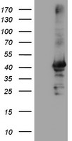 CRYZL1 Antibody - HEK293T cells were transfected with the pCMV6-ENTRY control (Left lane) or pCMV6-ENTRY CRYZL1 (Right lane) cDNA for 48 hrs and lysed. Equivalent amounts of cell lysates (5 ug per lane) were separated by SDS-PAGE and immunoblotted with anti-CRYZL1.