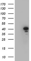CRYZL1 Antibody - HEK293T cells were transfected with the pCMV6-ENTRY control (Left lane) or pCMV6-ENTRY CRYZL1 (Right lane) cDNA for 48 hrs and lysed. Equivalent amounts of cell lysates (5 ug per lane) were separated by SDS-PAGE and immunoblotted with anti-CRYZL1.