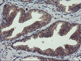 CRYZL1 Antibody - IHC of paraffin-embedded Human prostate tissue using anti-CRYZL1 mouse monoclonal antibody.