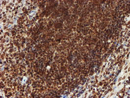 CRYZL1 Antibody - IHC of paraffin-embedded Human tonsil using anti-CRYZL1 mouse monoclonal antibody. (Heat-induced epitope retrieval by 10mM citric buffer, pH6.0, 100C for 10min).