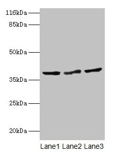 CRYZL1 Antibody - Western blot All lanes: CRYZL1 antibody at 12µg/ml Lane 1: Hela cells Lane 2: HepG2 cells Lane 3: Jurkat cells Secondary Goat polyclonal to rabbit IgG at 1/10000 dilution Predicted band size: 39, 22 kDa Observed band size: 39 kDa