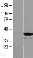 CRYZL1 Protein - Western validation with an anti-DDK antibody * L: Control HEK293 lysate R: Over-expression lysate