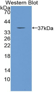 CS / Citrate Synthase Antibody - Western blot of recombinant CS / Citrate Synthase.