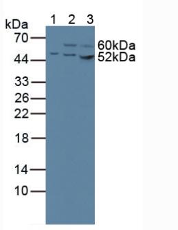 CS / Citrate Synthase Antibody - Western Blot; Sample: Lane1: Human 293T Cells; Lane2: Human Hela Cells; Lane3: Human HepG2 Cells.