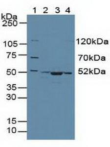 CS / Citrate Synthase Antibody - Western Blot; Sample: Lane1: Human 293T Cells; Lane2: Human Hela Cells; Lane3: Mouse Skeletal Muscle Tissue; Lane4: Human HepG2 Cells.
