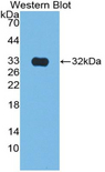 CS / Citrate Synthase Antibody - Western blot of recombinant CS / Citrate Synthase.