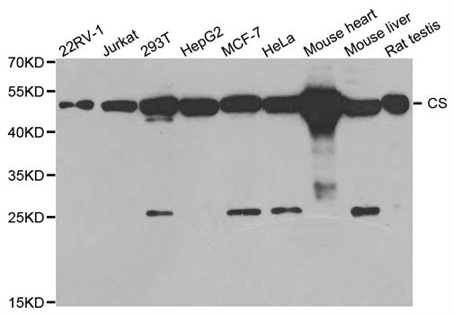 CS / Citrate Synthase Antibody - Western blot analysis of extracts of various cells.