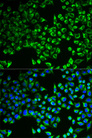 CS / Citrate Synthase Antibody - Immunofluorescence analysis of MCF-7 cells.