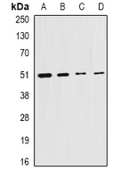CS / Citrate Synthase Antibody - Western blot analysis of Citrate Synthase expression in HepG2 (A); MCF7 (B); mouse liver (C); rat testis (D) whole cell lysates.