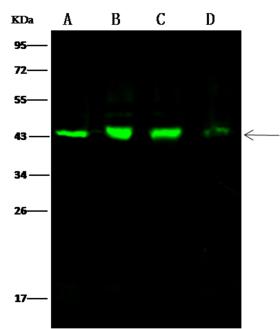 CS / Citrate Synthase Antibody - Anti-CS rabbit polyclonal antibody at 1:500 dilution. Lane A: A375 Whole Cell Lysate. Lane B: HepG2 Whole Cell Lysate. Lane C: Caco-2 Whole Cell Lysate. Lane D: HeLa Whole Cell Lysate. Lysates/proteins at 30 ug per lane. Secondary: Goat Anti-Rabbit IgG H&L (Dylight 800) at 1/10000 dilution. Developed using the Odyssey technique. Performed under reducing conditions. Predicted band size: 51 kDa. Observed band size: 45 kDa.