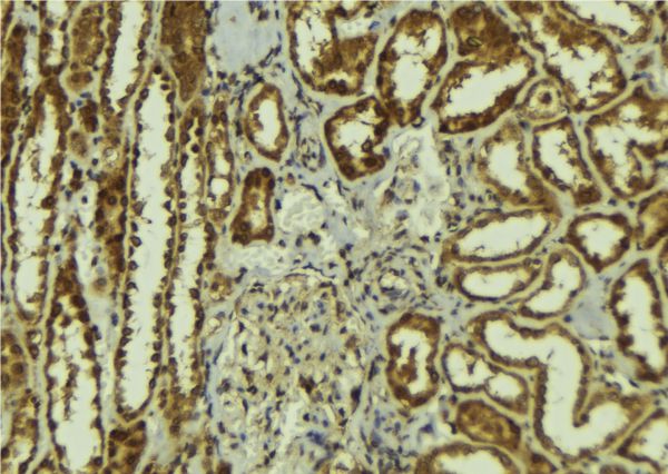 CS1 / CLSTN1 Antibody - 1:100 staining mouse kidney tissue by IHC-P. The sample was formaldehyde fixed and a heat mediated antigen retrieval step in citrate buffer was performed. The sample was then blocked and incubated with the antibody for 1.5 hours at 22°C. An HRP conjugated goat anti-rabbit antibody was used as the secondary.