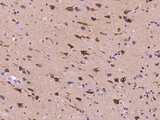 CS1 / CLSTN1 Antibody - Immunochemical staining of human CLSTN1 in human brain with rabbit polyclonal antibody at 1:2000 dilution, formalin-fixed paraffin embedded sections.