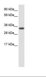 CSA / ERCC8 Antibody - Fetal Skeletal Muscle Lysate.  This image was taken for the unconjugated form of this product. Other forms have not been tested.