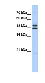 CSA / ERCC8 Antibody - ERCC8 antibody Western blot of HepG2 cell lysate. This image was taken for the unconjugated form of this product. Other forms have not been tested.