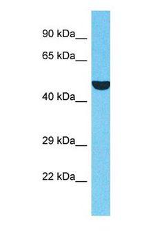 CSA / ERCC8 Antibody - Western blot of ERCC8 Antibody with human HepG2 Whole Cell lysate.  This image was taken for the unconjugated form of this product. Other forms have not been tested.