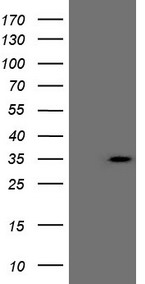 CSA / ERCC8 Antibody - HEK293T cells were transfected with the pCMV6-ENTRY control. (Left lane) or pCMV6-ENTRY ERCC8. (Right lane) cDNA for 48 hrs and lysed. Equivalent amounts of cell lysates. (5 ug per lane) were separated by SDS-PAGE and immunoblotted with anti-ERCC8. (1:500)