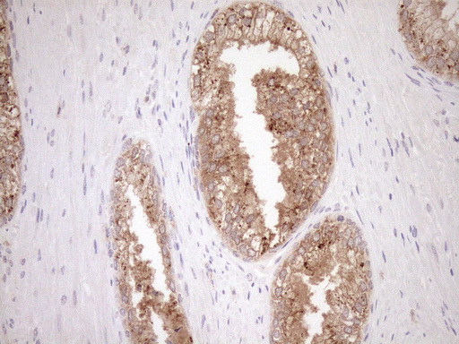 CSA / ERCC8 Antibody - Immunohistochemical staining of paraffin-embedded Human prostate tissue within the normal limits using anti-ERCC8 mouse monoclonal antibody. (Heat-induced epitope retrieval by 1mM EDTA in 10mM Tris buffer. (pH8.5) at 120°C for 3 min. (1:150)