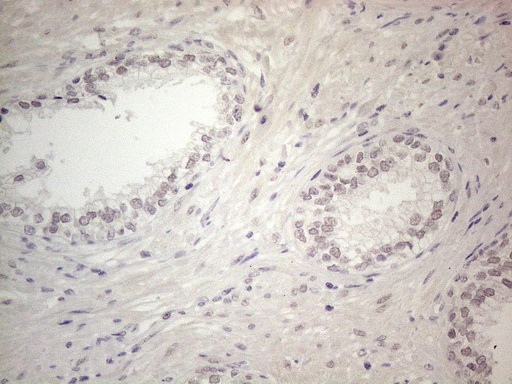 CSA / ERCC8 Antibody - Immunohistochemical staining of paraffin-embedded Human prostate tissue within the normal limits using anti-ERCC8 mouse monoclonal antibody. (Heat-induced epitope retrieval by 1mM EDTA in 10mM Tris buffer. (pH8.5) at 120°C for 3 min. (1:150)