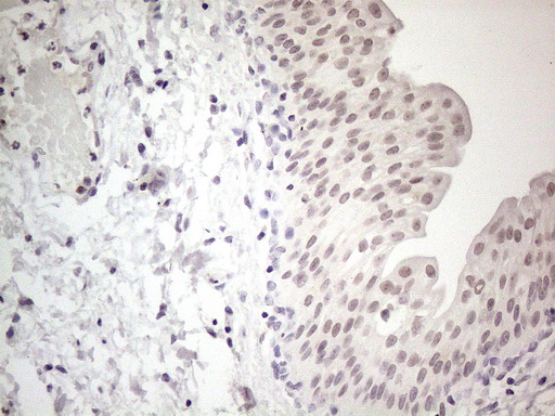 CSA / ERCC8 Antibody - Immunohistochemical staining of paraffin-embedded Human bladder tissue within the normal limits using anti-ERCC8 mouse monoclonal antibody. (Heat-induced epitope retrieval by 1mM EDTA in 10mM Tris buffer. (pH8.5) at 120°C for 3 min. (1:150)