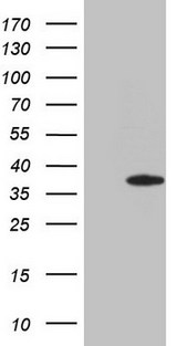 CSA / ERCC8 Antibody - HEK293T cells were transfected with the pCMV6-ENTRY control. (Left lane) or pCMV6-ENTRY ERCC8. (Right lane) cDNA for 48 hrs and lysed. Equivalent amounts of cell lysates. (5 ug per lane) were separated by SDS-PAGE and immunoblotted with anti-ERCC8. (1:2000)