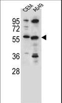 CSAD / CSD Antibody - CSAD Antibody western blot of CEM,A549 cell line lysates (35 ug/lane). The CSAD antibody detected the CSAD protein (arrow).