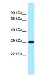 CSAD / CSD Antibody - CSAD / CSD antibody Western Blot of 721_B.  This image was taken for the unconjugated form of this product. Other forms have not been tested.