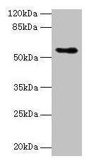 CSAD / CSD Antibody - Western blot All lanes: Csad antibody at 12µg/ml + NIH/3T3 whole cell lysate Secondary Goat polyclonal to rabbit IgG at 1/10000 dilution Predicted band size: 55 kDa Observed band size: 55 kDa
