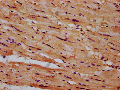 CSAD / CSD Antibody - Immunohistochemistry Dilution at 1:600 and staining in paraffin-embedded human heart tissue performed on a Leica BondTM system. After dewaxing and hydration, antigen retrieval was mediated by high pressure in a citrate buffer (pH 6.0). Section was blocked with 10% normal Goat serum 30min at RT. Then primary antibody (1% BSA) was incubated at 4°C overnight. The primary is detected by a biotinylated Secondary antibody and visualized using an HRP conjugated SP system.