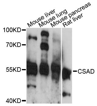 CSAD / CSD Antibody - Western blot analysis of extracts of various cell lines, using CSAD antibody at 1:3000 dilution. The secondary antibody used was an HRP Goat Anti-Rabbit IgG (H+L) at 1:10000 dilution. Lysates were loaded 25ug per lane and 3% nonfat dry milk in TBST was used for blocking. An ECL Kit was used for detection and the exposure time was 30s.